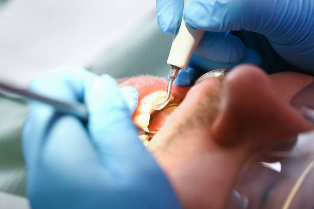 Best Emergency Dental Care for Trauma or Injury in Vilge St George, LA